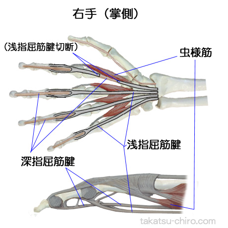 浅指屈筋腱と深指屈筋腱の構造