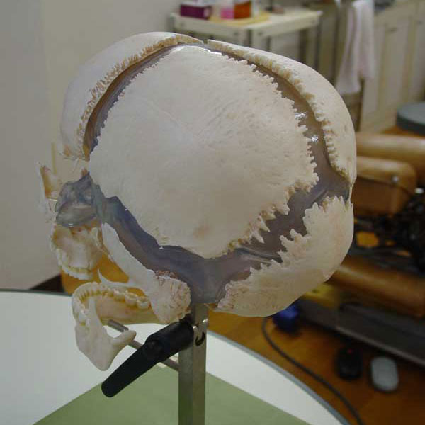 頭蓋骨の分解模型・後上側面