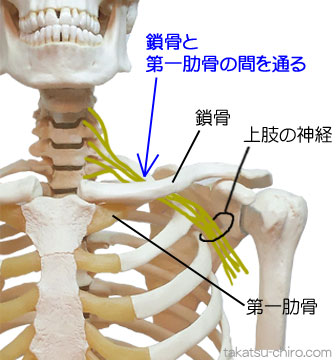 肋鎖症候群、鎖骨と第一肋骨の間を通る神経
