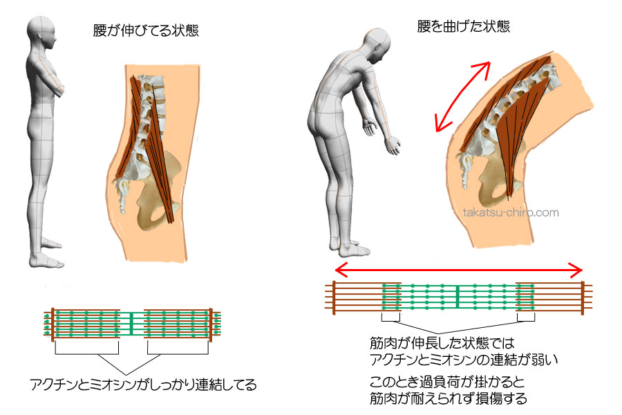 ぎっくり腰発症のメカニズム