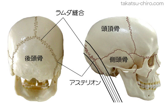 スーパーフィシャル・フロント・ライン、ラムダ縫合、アステリオン