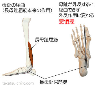 長母趾屈筋の外反母趾への影響