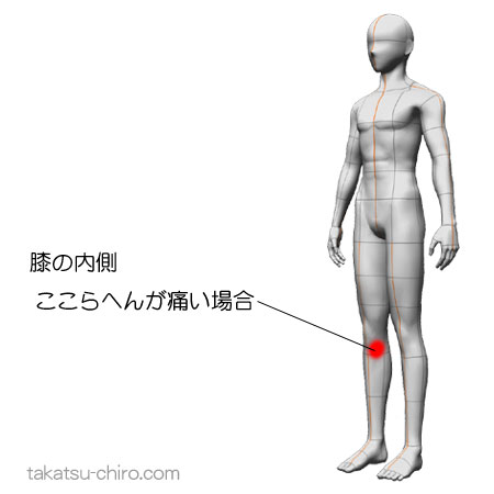 鵞足炎、膝の内側の痛み
