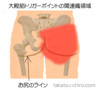大殿筋の下肢の痛みの領域