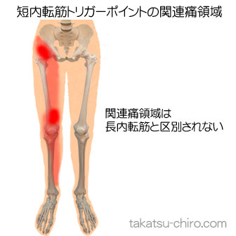 短内転筋の下肢の痛みの領域