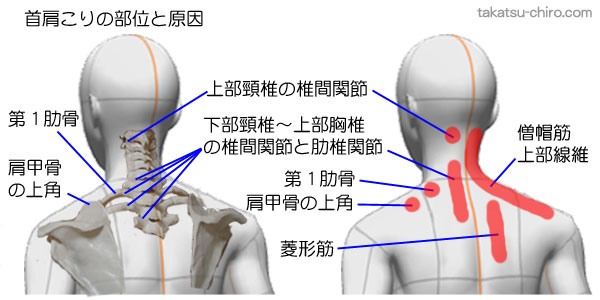 首肩のこりの部位と原因