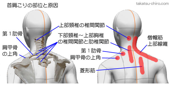 首肩のこりの部位と原因