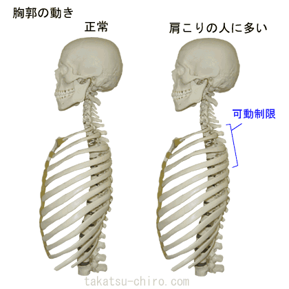 肋椎関節の機能障害、肩こり