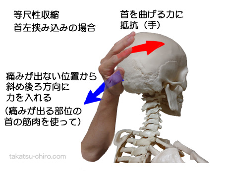首寝違えたときの解消法、エクササイズ（等尺性収縮）