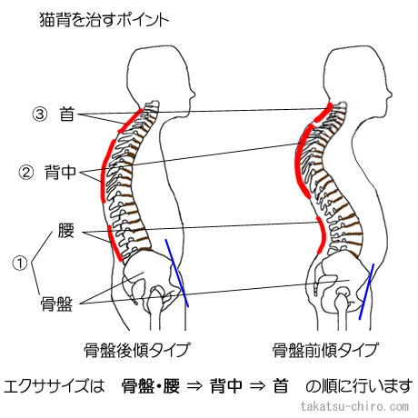 猫背を自分で治す方法