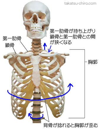 背骨が歪んで胸郭が歪み鎖骨と第一肋骨の間が狭くなる
