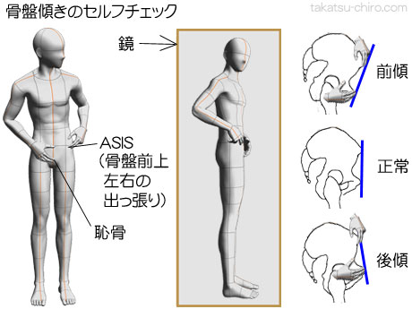 猫背を自分で治す方法、猫背のタイプを自分で判定