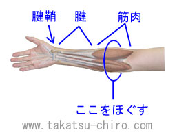 腱鞘炎が治らない場合にほぐす場所