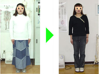 耳つぼダイエット、ビフォーアフター