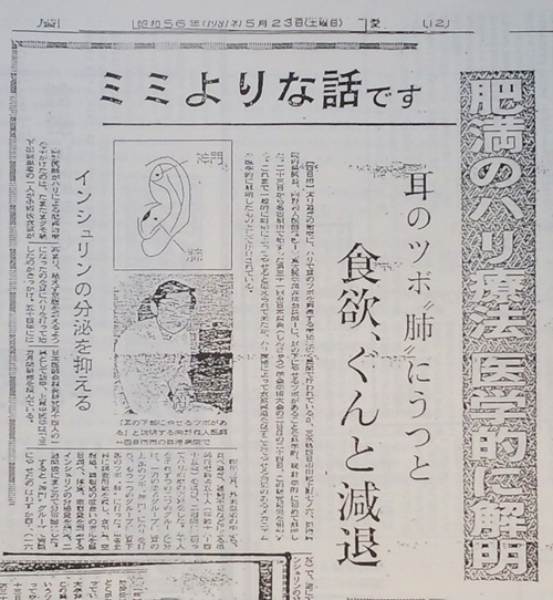 耳つぼダイエットの新聞記事