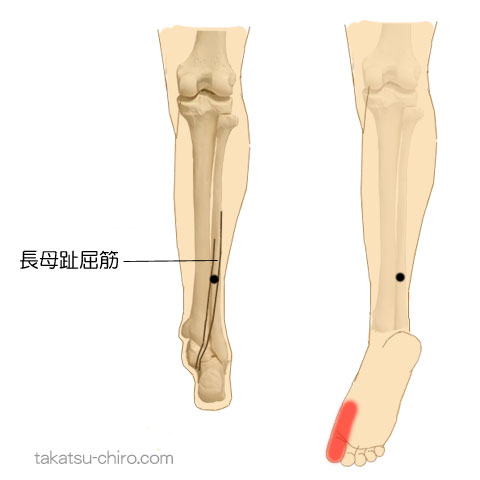 長母趾屈筋のトリガーポイント関連痛領域