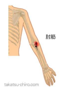 肘筋のトリガーポイント関連痛領域