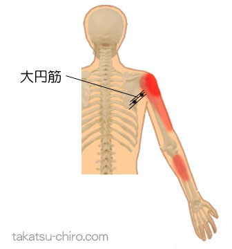 大円筋のトリガーポイント関連痛領域