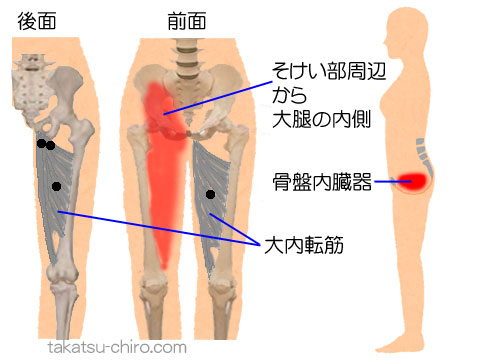 大内転筋のトリガーポイント関連痛領域