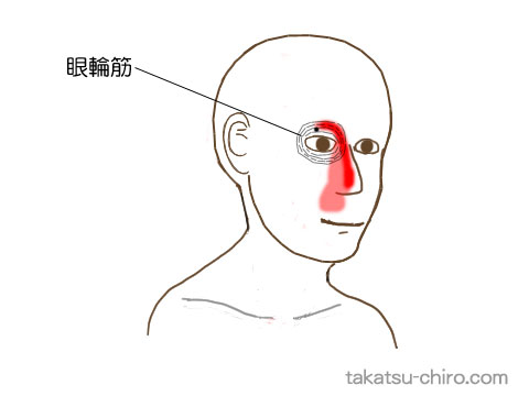眼輪筋のトリガーポイント関連痛領域