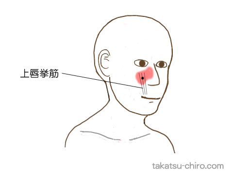 上唇挙筋のトリガーポイント関連痛領域