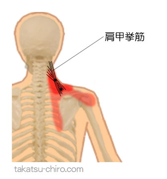 肩甲挙筋のトリガーポイント関連痛領域