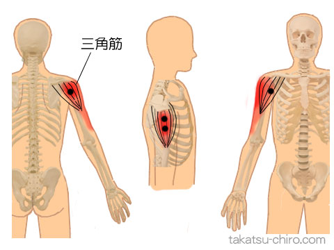 三角筋のトリガーポイント関連痛領域