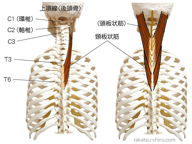 頸板状筋