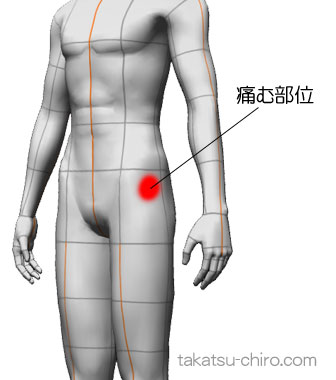 しゃがむと左股関節？が痛い（症例）
