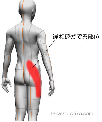 右腰から右大腿外側に違和感がでる(症例)