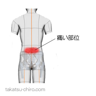 椅子から立ち上がるとき腰が痛い(症例)