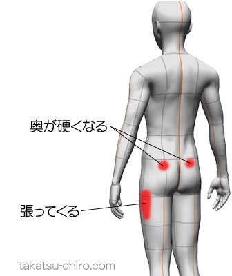 座ってるとお尻の奥が硬くなり、左大腿の外側が張ってくる(症例)