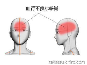 おでこのあたりの頭痛（症例）