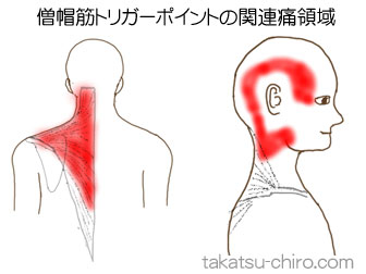 僧帽筋の顔の痛みの領域