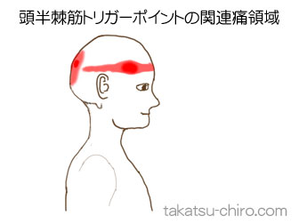 頭半棘筋の顔の痛みの領域