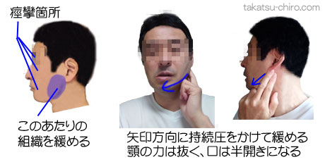 瞼、目の下、頬、唇などがピクピク痙攣するときの止め方