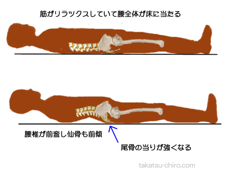 仰向けに寝るときの尾骨痛