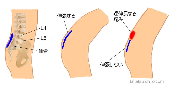 よくある前傾で腰が痛い原因