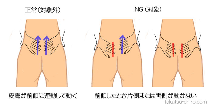 腰を曲げると痛いときの自分でできる対処法の適応かどうかの判断
