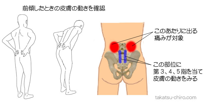 腰を曲げると痛いときの自分でできる対処法の適応かどうかの検査